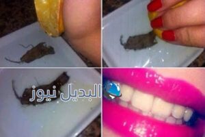 تبيض الأسنان