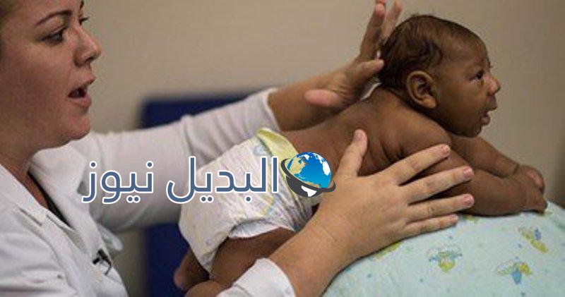 فيروس زيكا
