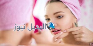 وصفة للتخلص من حب الشباب