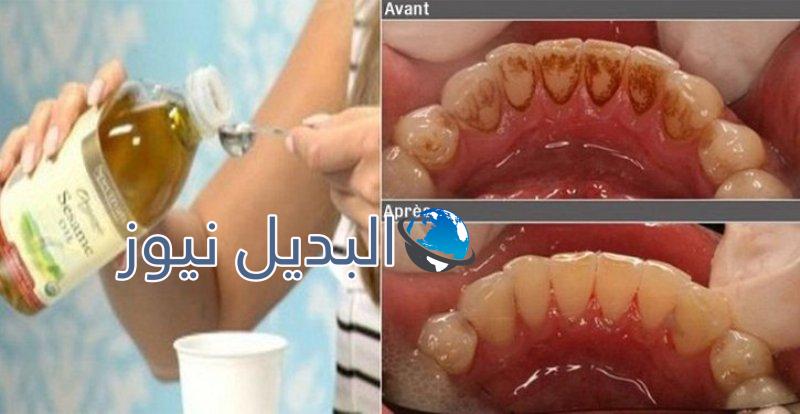 التخلص من آلام الأسنان وأمراض الفم