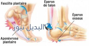 التخلص من آلام الكعب