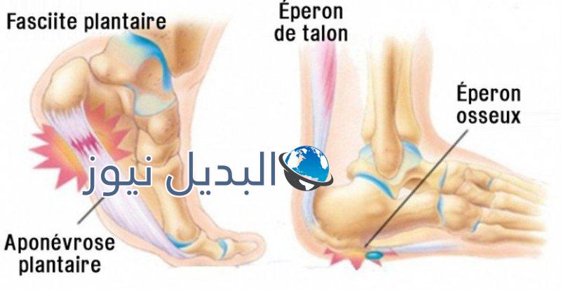 التخلص من آلام الكعب