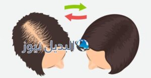 تقوية الشعر وإطالته