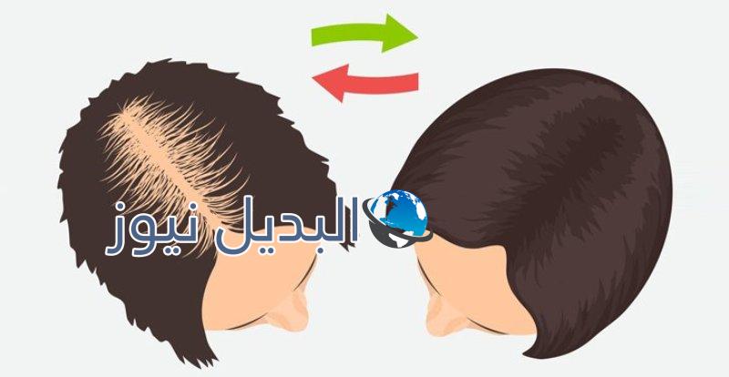 تقوية الشعر وإطالته