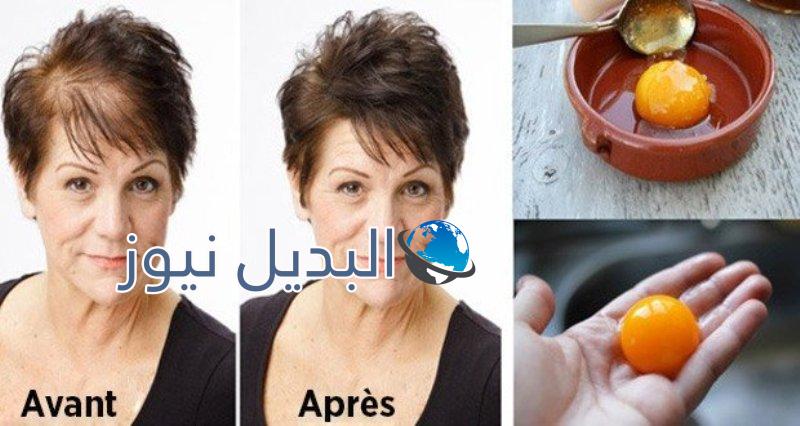 تكثيف الشعر في أقل من شهر