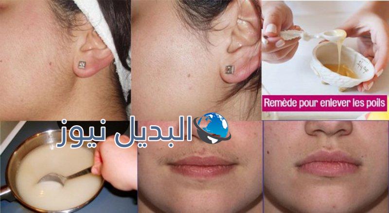 التخلص من شعر الوجه بشكل نهائي