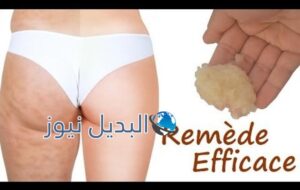 التخلص من سيلوليت الأرداف والفخذين