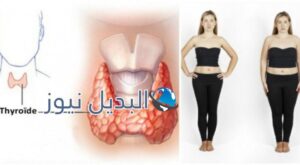 إنقاص الوزن