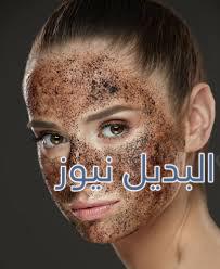 خلطة لازالة حب الشباب