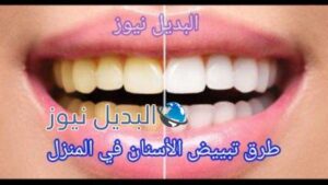طرق تبييض الأسنان في المنزل