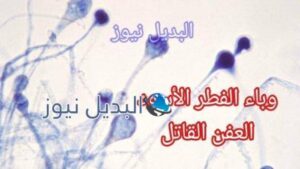 وباء الفطر الأسود في الهند العفن القاتل