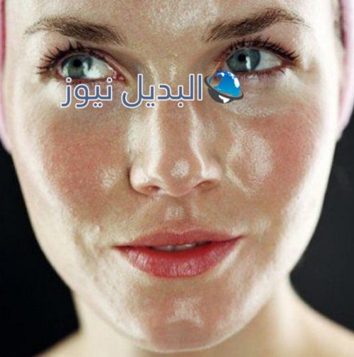 تقشير البشرة الدهنية