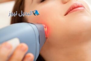 تقشير البشرة وأنواعها