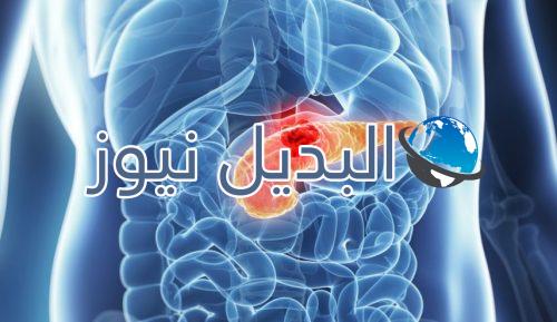 أعراض سرطان المعدة طرق العلاج وأسباب الإصابة