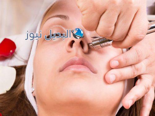 تقشير البشرة بالليزر وأحدث التقنيات الطبية