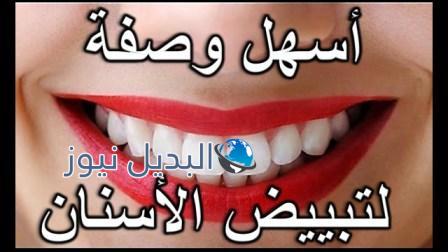 أفضل الوصفات الطبيعية لتبييض الأسنان