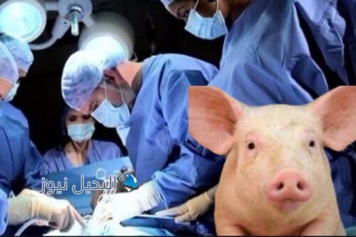 زراعة كلية الخنزير