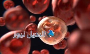 اسباب واعراض و لون دم الاجهاض بالصور