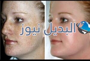 طريقة استعمال مني الرجل للوجه ، فوائد مني الرجل للوجه