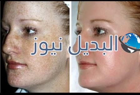 طريقة استعمال مني الرجل للوجه ، فوائد مني الرجل للوجه