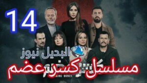كسر عضم ١٤
