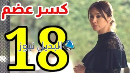 كسر عضم١٨