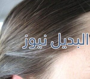 وصفة الشاي لعلاج شيب الشعر المبكر