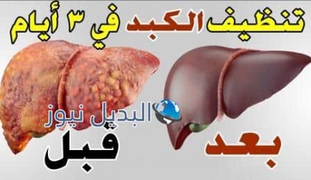 تنظيف الكبد من السموم