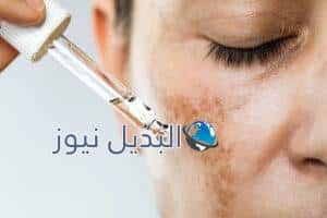 تفتيح البشره