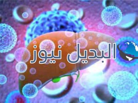 أعراض التهاب الكبد A وB وC