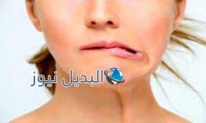 إلتهاب العصب السابع وعلاقته بالسكري