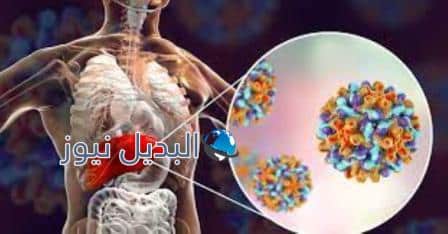 كيفية علاج التهاب الكبد الحاد