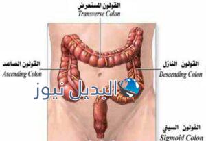 ما هو القولون السيني